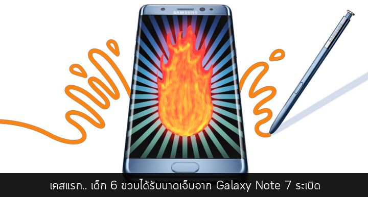 เคสแรก.. เด็ก 6 ขวบบาดเจ็บจาก Galaxy Note 7 ระเบิด (update : ไม่ใช่ Note 7 ที่ไหม้ แต่เป็น Galaxy Core Prime)
