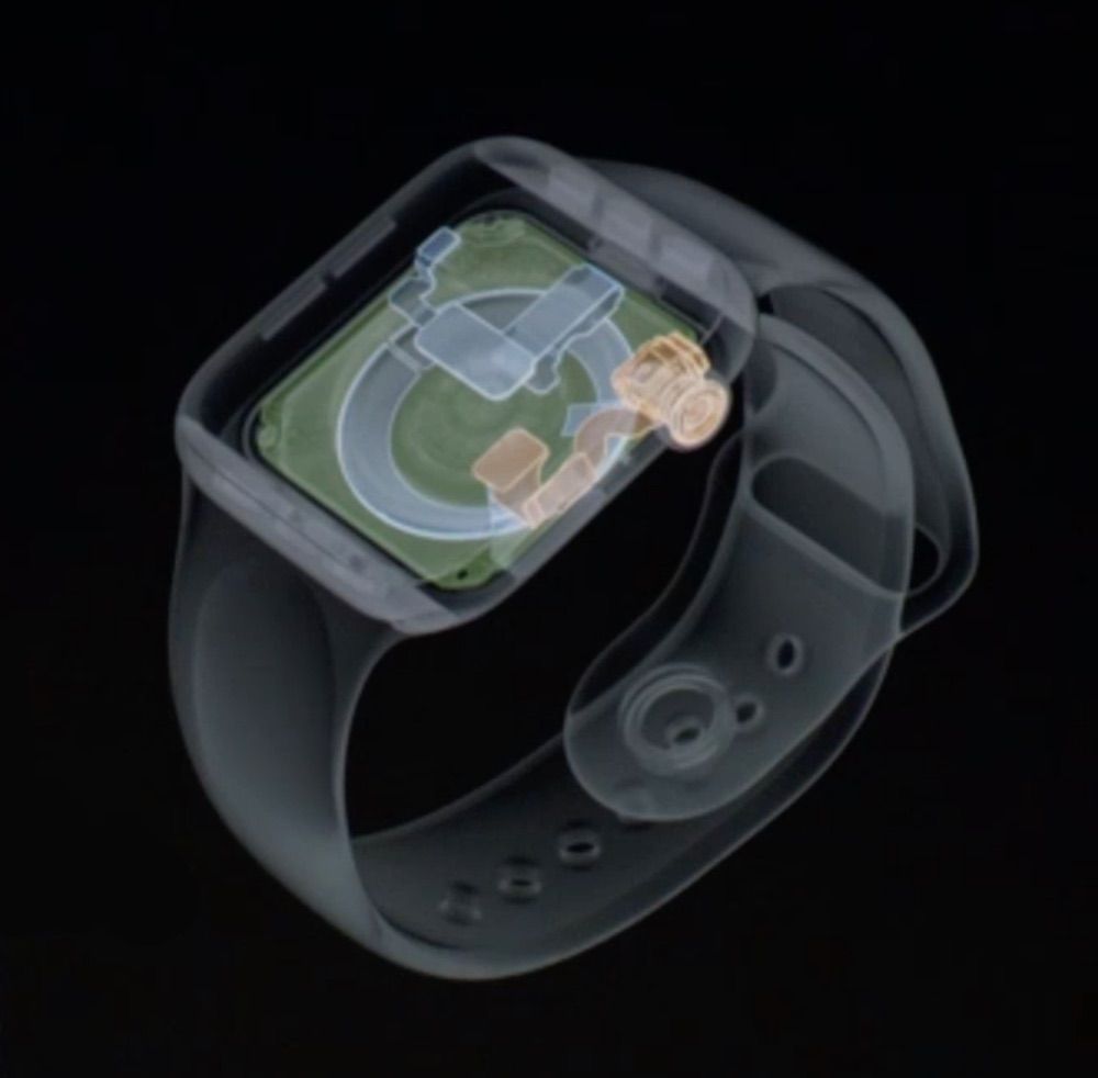 ทำความเข้าใจ Apple Watch 4 ค่า ECG สามารถใช้งานได้ขนาดไหน? และความเป็นห่วงในมุมมองแพทย์