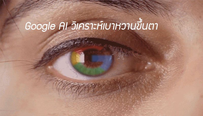 Google ร่วมมือกับโรงพยาบาลราชวิถี พัฒนาระบบ AI วิเคราะห์ภาวะเบาหวานขึ้นตา