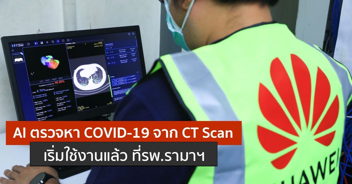 AI ตรวจ COVID-19 ถึงไทยแล้ว ประมวลผลภาพ CT Scan แค่หลักวินาทีแต่อ่านผลได้แม่นยำถึง 96%